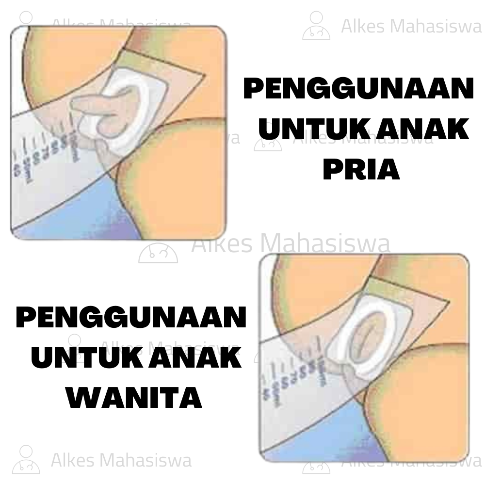 Alat Tampung urine Bayi / Paediatric Urine Collector Onemed