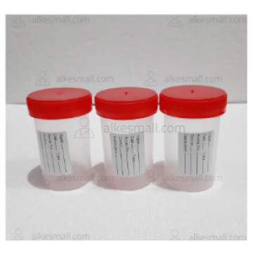 Urine Container Dahak Container 50ml